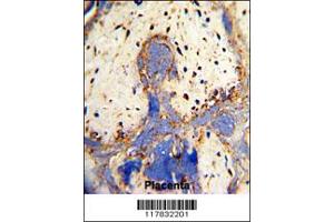Immunohistochemistry (IHC) image for anti-Carboxypeptidase Z (CPZ) antibody (ABIN2158356)