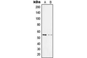 Image no. 3 for anti-Kruppel-Like Factor 11 (KLF11) (N-Term) antibody (ABIN2707602)