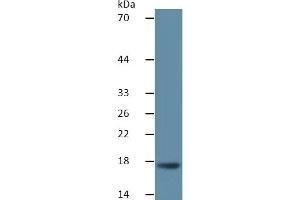 Renin ELISA Kit