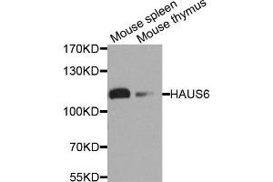Image no. 1 for anti-HAUS Augmin-Like Complex, Subunit 6 (HAUS6) antibody (ABIN1679814)