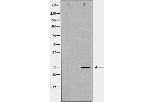 Image no. 1 for anti-Suppressor of Cytokine Signaling 3 (SOCS3) (C-Term) antibody (ABIN6265217)