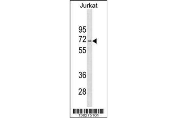 anti-Jerky Homolog-Like (JRKL) (AA 412-439), (C-Term) antibody