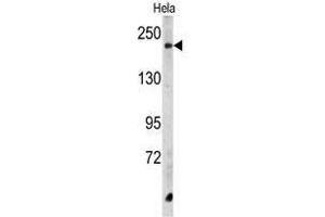 Image no. 1 for anti-Carboxypeptidase D (CPD) (C-Term) antibody (ABIN452867)