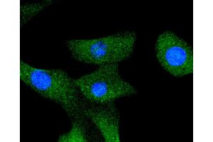 Image no. 2 for anti-V-Raf Murine Sarcoma 3611 Viral Oncogene Homolog (ARAF) antibody (ABIN5557283)