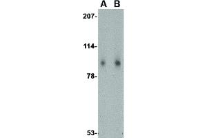 anti-SLIT and NTRK-Like Family, Member 1 (SLITRK1) (Internal Region) antibody