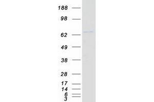 Image no. 1 for DEAD (Asp-Glu-Ala-Asp) Box Polypeptide 41 (DDX41) protein (Myc-DYKDDDDK Tag) (ABIN2719284)