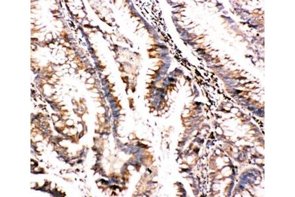 BAG3 antibody  (C-Term)