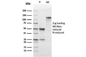 Image no. 5 for anti-Sialophorin (SPN) antibody (ABIN6940641)