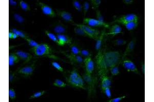 Image no. 5 for anti-Mast/stem Cell Growth Factor Receptor (KIT) (AA 350-440) antibody (ABIN1387260)