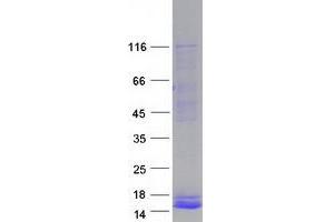 Image no. 1 for Pancreatic Polypeptide (PPY) protein (Myc-DYKDDDDK Tag) (ABIN2728198)