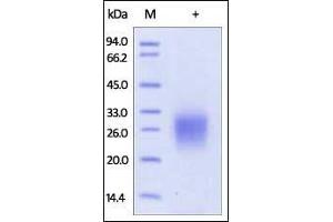 Image no. 1 for HLA-DR-gamma (CD74) (AA 73-232) protein (His tag) (ABIN2180835)