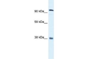 Image no. 4 for anti-MDS1 and EVI1 Complex Locus (MECOM) (C-Term) antibody (ABIN2777403)