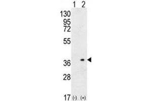 Image no. 3 for anti-Major Histocompatibility Complex, Class II, DQ alpha 1 (HLA-DQA1) (AA 39-66) antibody (ABIN3031680)