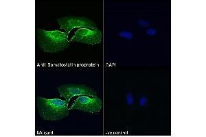 Image no. 2 for anti-Somatostatin (SST) (AA 58-70) antibody (ABIN7013881)