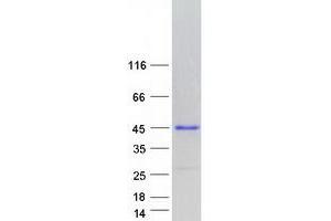 Image no. 1 for Endonuclease, PolyU-Specific (ENDOU) (Transcript Variant 3) protein (Myc-DYKDDDDK Tag) (ABIN2729405)