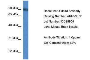 Image no. 1 for anti-phosphodiesterase 4D, cAMP-Specific (PDE4D) (N-Term) antibody (ABIN2786830)