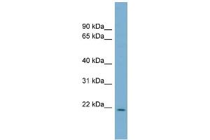 Image no. 1 for anti-Protein CutA (CUTA) (Middle Region) antibody (ABIN2781968)