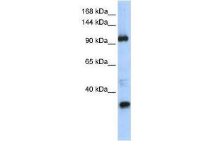 Image no. 1 for anti-Terminal Uridylyl Transferase 1, U6 SnRNA-Specific (TUT1) (Middle Region) antibody (ABIN927828)