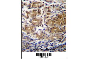 Image no. 2 for anti-Pyruvate Dehydrogenase Phosphatase Regulatory Subunit (PDPR) (C-Term) antibody (ABIN2496025)