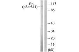 Image no. 1 for anti-Retinoblastoma Protein (Rb Protein) (AA 771-820), (pSer811) antibody (ABIN1531515)