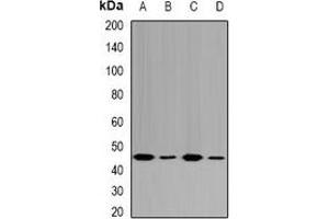 Image no. 1 for anti-Fumarylacetoacetate Hydrolase (Fumarylacetoacetase) (FAH) antibody (ABIN2966649)