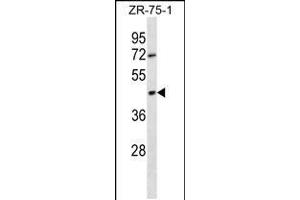 OR2T6 antibody  (C-Term)