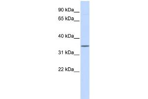 Image no. 1 for anti-Wingless-Type MMTV Integration Site Family, Member 1 (WNT1) (Middle Region) antibody (ABIN2779465)