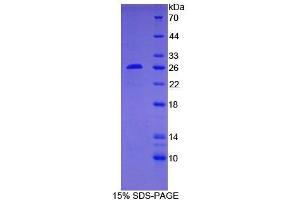 Image no. 1 for B-Cell CLL/lymphoma 2 (BCL2) ELISA Kit (ABIN6574202)