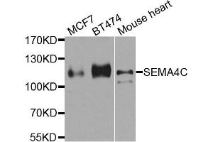 Image no. 1 for anti-Sema Domain, Immunoglobulin Domain (Ig), Transmembrane Domain (TM) and Short Cytoplasmic Domain, (Semaphorin) 4C (SEMA4C) antibody (ABIN2737519)