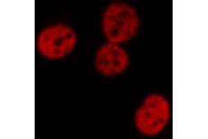 Image no. 3 for anti-Signal Transducer and Activator of Transcription 1, 91kDa (STAT1) (pTyr701) antibody (ABIN6255991)