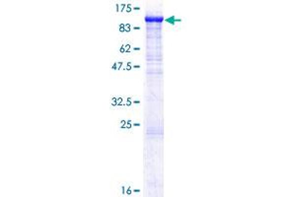 ZP2 Protein (Zona Pellucida Glycoprotein 2) (AA 1-736) (GST tag)