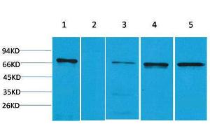 Image no. 1 for anti-Zinc Finger and BTB Domain Containing 45 (ZBTB45) antibody (ABIN3181502)