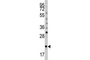 Image no. 4 for anti-BH3 Interacting Domain Death Agonist (BID) (AA 39-68) antibody (ABIN3030161)