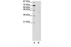 Image no. 1 for anti-PiggyBac Transposable Element Derived 1 (PGBD1) (AA 721-770) antibody (ABIN202922)