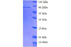 Image no. 1 for Keratin 8 (KRT8) (AA 2-483), (full length) protein (His tag) (ABIN1047299)
