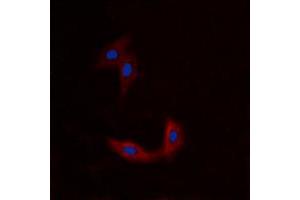 Image no. 2 for anti-BMX Non-Receptor Tyrosine Kinase (BMX) (N-Term) antibody (ABIN2707370)
