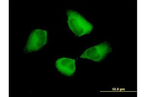 Image no. 2 for anti-Programmed Cell Death 6 Interacting Protein (PDCD6IP) (AA 1-868) antibody (ABIN523392)