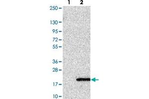Image no. 1 for anti-UFM1-Specific Peptidase 1 (Non-Functional) (UFSP1) antibody (ABIN5590554)