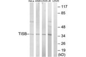 Image no. 1 for anti-ZFP36 Ring Finger Protein-Like 1 (ZFP36L1) (AA 58-107) antibody (ABIN1532761)