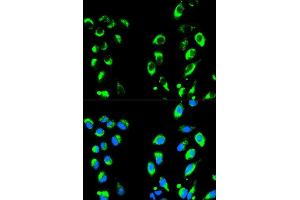 Image no. 3 for anti-Nuclear Factor of kappa Light Polypeptide Gene Enhancer in B-Cells Inhibitor, alpha (NFKBIA) antibody (ABIN3021668)