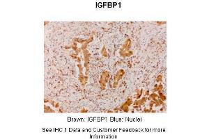 Image no. 3 for anti-Insulin-Like Growth Factor 2 mRNA Binding Protein 1 (IGF2BP1) (N-Term) antibody (ABIN2778994)