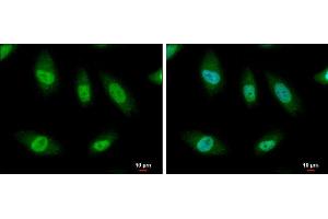 Image no. 3 for anti-Cyclin D3 (CCND3) (Center) antibody (ABIN2855080)