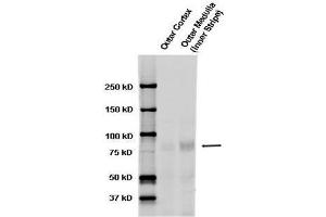 Image no. 2 for anti-Sodium Channel, Nonvoltage-Gated 1 alpha (SCNN1A) (AA 46-68) antibody (ABIN863202)