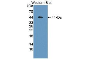 Image no. 2 for anti-Complement Factor H (CFH) (AA 879-1236) antibody (ABIN5013384)