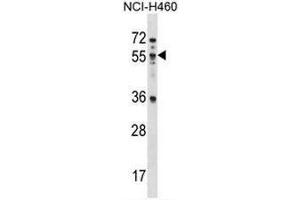 MEX3B Antibody (N-term) western blot analysis in NCI-H460 cell line lysates (35µg/lane).