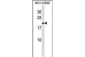 Image no. 2 for anti-High Mobility Group Box 3 (HMGB3) (AA 50-79) antibody (ABIN5536253)
