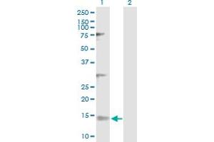 Image no. 1 for anti-NADH Dehydrogenase (Ubiquinone) Flavoprotein 3, 10kDa (NDUFV3) (AA 1-108) antibody (ABIN518270)