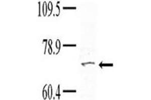 Image no. 1 for anti-Tyrosine Kinase, Non-Receptor, 1 (TNK1) (Middle Region) antibody (ABIN359998)