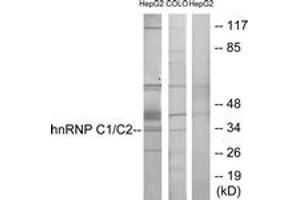 Image no. 1 for anti-Heterogeneous Nuclear Ribonucleoprotein C (C1/C2) (HNRNPC) (AA 241-290) antibody (ABIN1533594)
