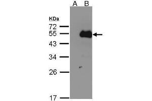 Image no. 1 for anti-Nuclear Factor I/B (NFIB) (Center) antibody (ABIN2856178)